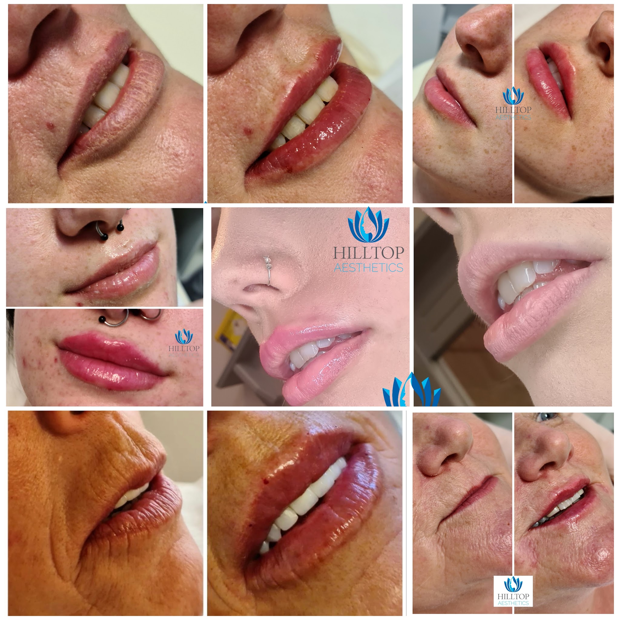 Collage of cosmetic treatment results.